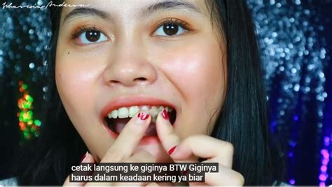 Cara Membuat Gigi Gingsul Idaman dalam 10 Langkah Mudah